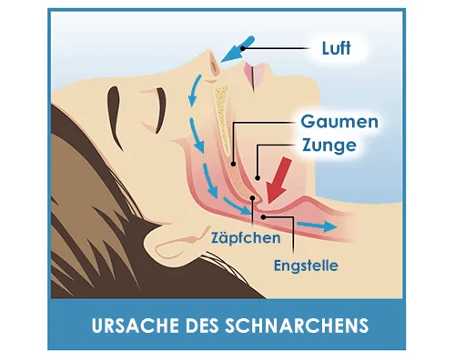 Ursache des Schnarchens