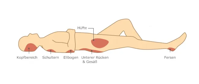 druckstellen beim schlafen